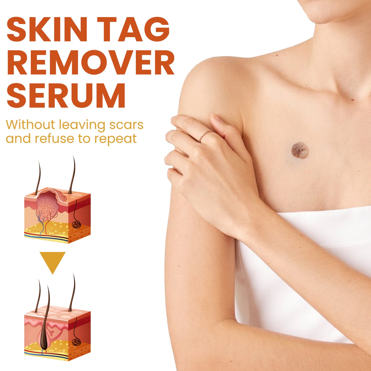 Cleansing Skin Wart Fading Black Mole Corns Mild And Smooth Skin Care Solution